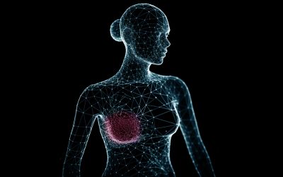 Breast Mesh