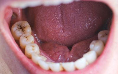 Tooth's,A,Man,Smoking,Bad.,Man,Smokes,A,Cigarettes,Have